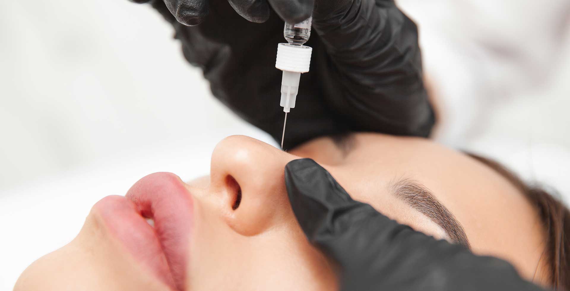 Rhinoplasetie médicale à Nantes chez le dr Chardonneau
