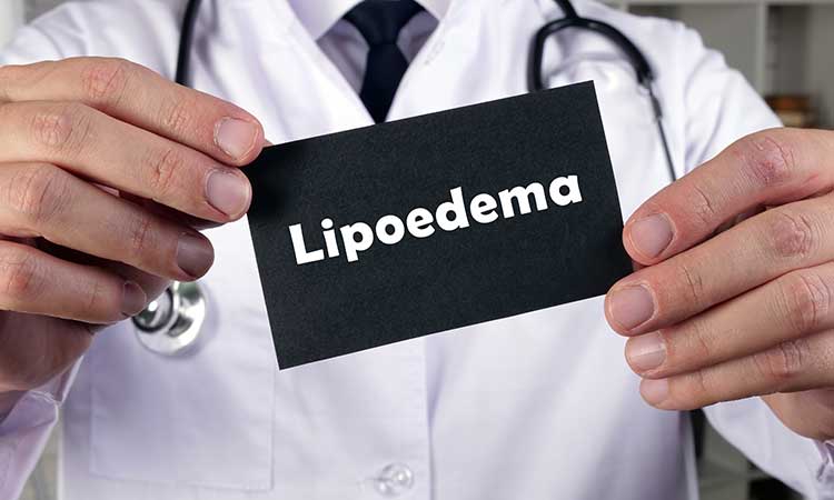 Lipoedeme : quelles strategies ?